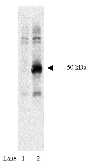 Western blot using anti-HA tag antibody (Cat. No. X1000) on HEK293 cells (1) and HEK293 cells expressing HA-tagged Rem protein at 1:1000 dilution.
